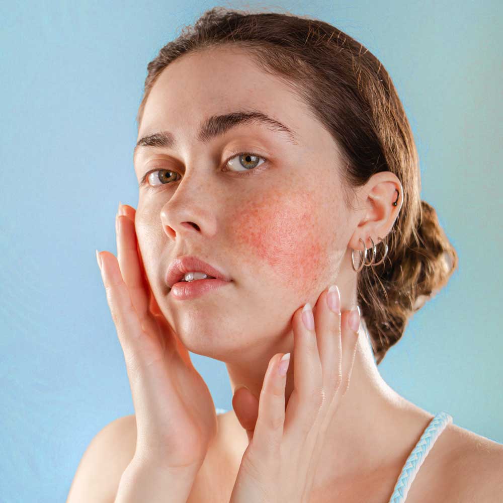 Red Avert Cleanser | Natural Face Cleanser Sensitive Skin | Adaptology